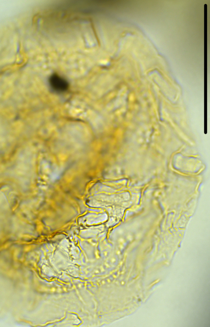 Heteraulacacysta pramparoae HprampX27390921351040Aa holotype 100x.jpg